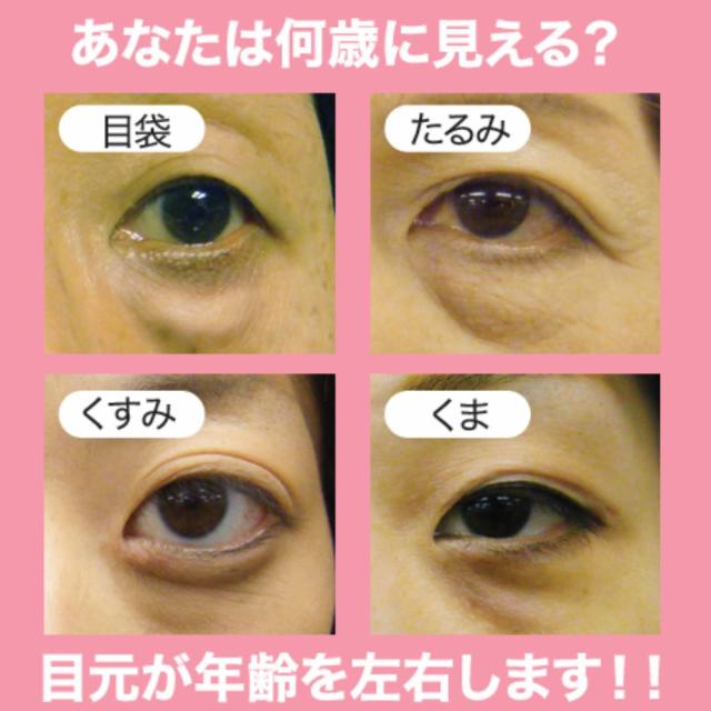 アイスラック クロフィート NEO 粘着パッド 2組付 目元美容器 目元ケア